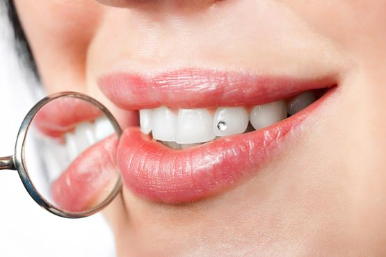 Happy Beauty Smile Crans-Montana dentist white teeth tooth jewellery